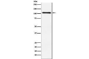 Western blot analysis of Protein Kinase D2 expression in HeLa cell lysate.