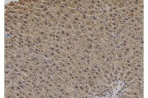 ABIN6276878 at 1/100 staining Mouse liver tissue by IHC-P. (Dynactin 1 anticorps  (C-Term))