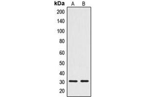 Western blot analysis of CTDSP1 expression in Jurkat (A), HuvEc (B) whole cell lysates. (CTDSP1 anticorps  (N-Term))