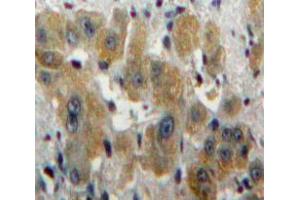 Used in DAB staining on fromalin fixed paraffin-embedded Liver tissue