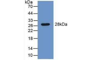 Detection of Recombinant LEI, Mouse using Polyclonal Antibody to Leukocyte Elastase Inhibitor (LEI)