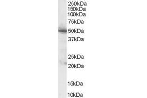 ABIN185389 (1µg/ml) staining of Human Pancreas lysate (35µg protein in RIPA buffer). (PDHX anticorps  (C-Term))
