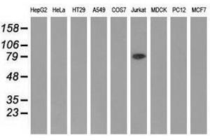 Image no. 1 for anti-Aldehyde Dehydrogenase 1 Family, Member L1 (ALDH1L1) antibody (ABIN1496581) (ALDH1L1 anticorps)