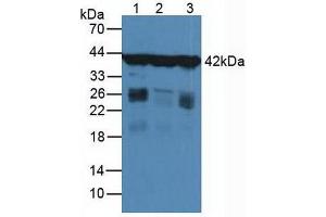 Figure. (Actin, gamma 1 anticorps  (AA 1-375))