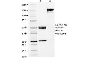 SDS-PAGE Analysis Purified FOXA1 Monoclonal Antibody (FOXA1/1512). (FOXA1 anticorps  (AA 372-472))