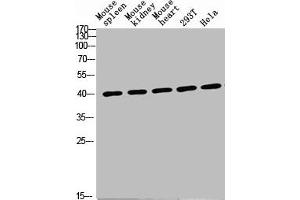 Western Blot analysis of various cells using Antibody diluted at 1:1000. (CD72 anticorps  (Internal Region))