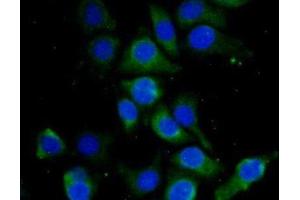 Detection of HBd in Human Hela Cell using Polyclonal Antibody to Hemoglobin Delta (HBd)