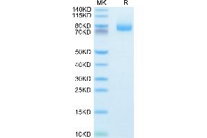 Human GITR Ligand (Trimer) on Tris-Bis PAGE under reduced condition.
