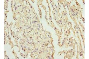 Immunohistochemistry of paraffin-embedded human lung tissue using ABIN7147382 at dilution of 1:100 (CEP120 anticorps  (AA 1-270))