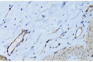 Immunohistochemistry of paraffin-embedded Human colon using MCAM Polyclonal Antibody at dilution of 1:100 (40x lens). (MCAM anticorps)