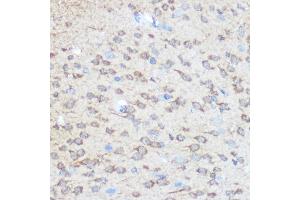 Immunohistochemistry of paraffin-embedded rat brain using Huntingtin Rabbit pAb (ABIN7267794) at dilution of 1:100 (40x lens). (Huntingtin anticorps)