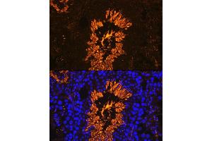 Immunofluorescence analysis of Mouse testis using  antibody (ABIN7265353) at dilution of 1:100. (AKAP4 anticorps  (AA 189-340))