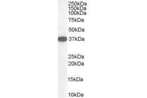 Image no. 1 for anti-Dimethylarginine Dimethylaminohydrolase 1 (DDAH1) (C-Term) antibody (ABIN374149) (DDAH1 anticorps  (C-Term))