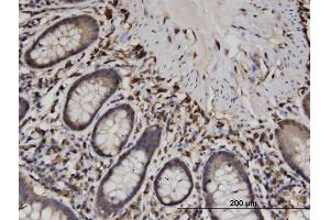 Immunoperoxidase of monoclonal antibody to CAPZB on formalin-fixed paraffin-embedded human small Intestine. (CAPZB anticorps  (AA 192-272))