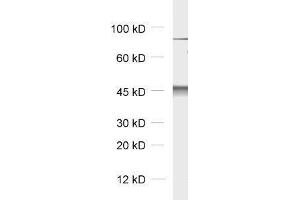 dilution: 1 : 5000, sample: rat brain homogenate (Cytohesin 2 anticorps)