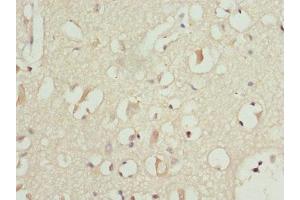 Immunohistochemistry of paraffin-embedded human brain tissue using ABIN7164274 at dilution of 1:100 (PITRM1 anticorps  (AA 758-1037))