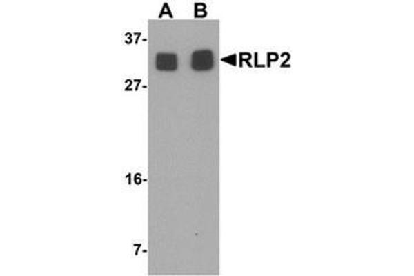 RILPL2 antibody  (Middle Region)