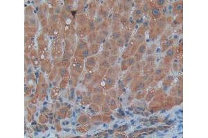 IHC-P analysis of Human Tissue, with DAB staining. (Thymic Stromal Lymphopoietin anticorps  (AA 29-159))