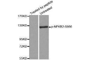 Western blot analysis of extracts from ovary cancer cells, using Phospho-NFKB2-S866 antibody (ABIN2988214). (NFKB2 anticorps  (pSer866))