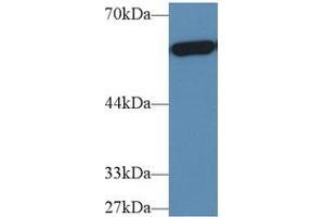 Detection of PKM2 in Human Hela cell lysate using Polyclonal Antibody to Pyruvate kinase isozymes M2 (PKM2)