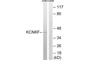 Western blot analysis of extracts from A549 cells, using KCNK15 antibody. (KCNK15 anticorps  (C-Term))