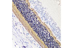 Immunohistochemistry of paraffin-embedded rat retina using PDC antibody (ABIN7269269) at dilution of 1:200 (40x lens).