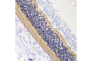 Immunohistochemistry of paraffin-embedded rat retina using PDC antibody (ABIN7269269) at dilution of 1:200 (40x lens). (Phosducin anticorps  (AA 1-246))