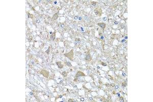 Immunohistochemistry of paraffin-embedded rat brain using VPS37A antibody. (VPS37A anticorps  (AA 224-397))