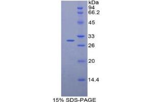 SDS-PAGE analysis of Mouse ALT2 Protein. (GPT2 Protéine)