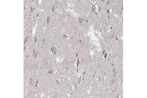 ABIN6266661 at 1/100 staining human brain tissue sections by IHC-P. (SUMO1 anticorps  (N-Term))