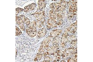 IHC analysis of ALDOA using anti-ALDOA antibody (ABIN7601907). (ALDOA anticorps  (AA 50-364))