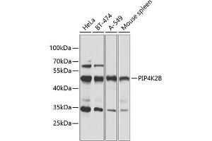 Western blot analysis of extracts of various cell lines, using PIP4K2B antibody (ABIN6130646, ABIN6145675, ABIN6145677 and ABIN6216199) at 1:1000 dilution.