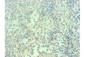 Immunohistochemical of paraffin-embedded human spleen tissue using ABIN7168560 at dilution of 1:200 (S100A9 anticorps)