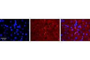 LBP antibody - C-terminal region          Formalin Fixed Paraffin Embedded Tissue:  Human Liver Tissue    Observed Staining:  Cell membrane in endothelial cell in sinusoids   Primary Antibody Concentration:  1:100    Other Working Concentrations:  1/600    Secondary Antibody:  Donkey anti-Rabbit-Cy3    Secondary Antibody Concentration:  1:200    Magnification:  20X    Exposure Time:  0.