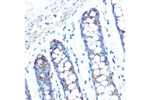 Immunohistochemistry of paraffin-embedded human colon using SFRP4 Rabbit mAb (ABIN7270180) at dilution of 1:100 (40x lens).