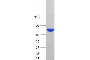 Validation with Western Blot