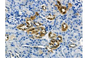 ABIN6264652 and ABIN6266628 at 1/100 staining Mouse kidney tissue by IHC-P. (RASH/RASK/RASN (N-Term) anticorps)