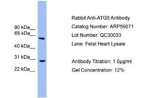 WB Suggested Anti-ATG5  Antibody Titration: 0. (ATG5 anticorps  (Middle Region))