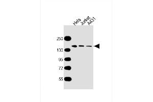All lanes : Anti-MYBBP1A Antibody at 1:5000 dilution Lane 1: Hela whole cell lysate Lane 2: Jurkat whole cell lysate Lane 3: A431 whole cell lysate Lysates/proteins at 20 μg per lane. (MYBBP1A anticorps  (AA 1104-1328))