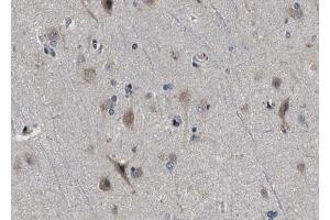 ABIN6272994 at 1/100 staining human brain tissue sections by IHC-P.
