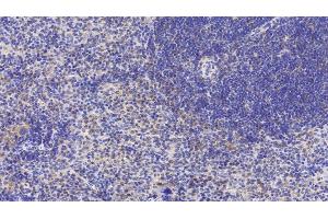 Detection of LY96 in Mouse Spleen Tissue using Polyclonal Antibody to Lymphocyte Antigen 96 (LY96) (LY96 anticorps  (AA 16-160))