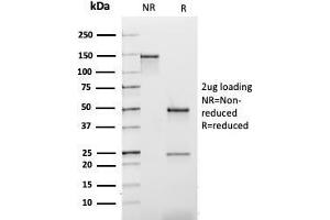 SDS-PAGE Analysis Purified Kappa Light Chain Mouse Recombinant Monoclonal Ab (rL1C1). (Recombinant IGKC anticorps)