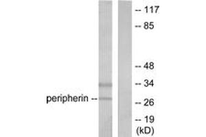 Western blot analysis of extracts from 293 cells, using PGP9. (UCHL1 anticorps  (AA 171-220))