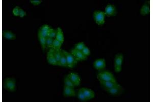 Immunofluorescence staining of HepG2 cells with ABIN7149966 at 1:100, counter-stained with DAPI. (DMGDH anticorps  (AA 429-524))