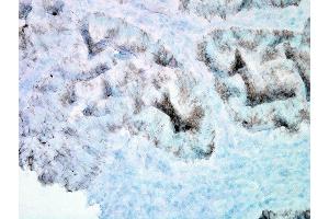 Immunohistochemistry analysis using Mouse Anti-Hsp60 Monoclonal Antibody, Clone LK-2 (ABIN361786 and ABIN361787). (HSPD1 anticorps)