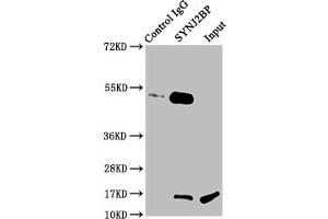 Immunoprecipitating SYNJ2BP in Rat kidney tissue Lane 1: Rabbit control IgG instead of ABIN7171128 in Rat kidney tissue.