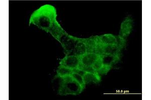 Immunofluorescence of monoclonal antibody to KLK8 on A-431 cell.