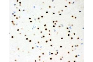 IHC-P testing of rat brain tissue (MSK1 anticorps  (AA 540-665))