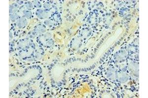 Immunohistochemistry of paraffin-embedded human pancreatic tissue using ABIN7163625 at dilution of 1:100 (PDGFD anticorps  (AA 191-370))