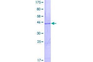 Image no. 1 for Diacylglycerol Kinase, epsilon 64kDa (DGKE) (AA 1-177) protein (GST tag) (ABIN1351512)